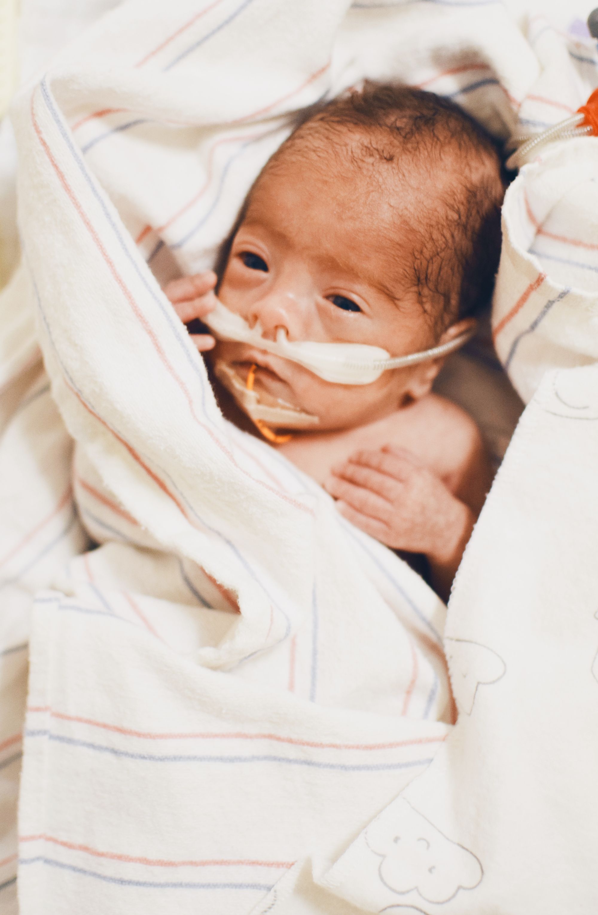 Pumping for Micropreemie | Miracle Medicine